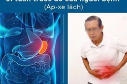 Áp-xe lách – bệnh lý rất nguy hiểm nhưng hiếm gặp đến mức bị…lãng quên