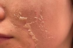 Trẻ khỏe dài lâu với 7 loại vitamin chống lão hóa tốt nhất