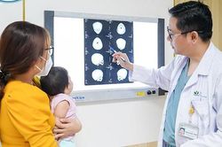 Nỗ lực tái tạo gương mặt cho bé gái mắc dị tật sọ mặt hiếm gặp