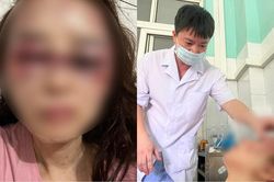 Thanh Hóa: Tạm giam cán bộ quản lý thị trường đánh đập dã man bạn gái