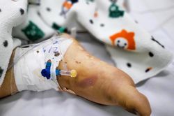 Nhiều trẻ sốt xuất huyết gặp biến chứng nặng, 'động đâu cũng chảy máu'