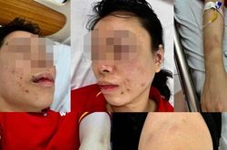 Người phụ nữ ở Hà Nội tố bị chồng cũ 'bắt cóc', đánh đập dã man