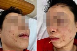 Người phụ nữ tố bị chồng cũ 'bắt cóc' đánh đập dã man: Hội LHPN quận Bắc Từ Liêm đề nghị xử lý nghiêm