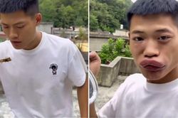 TikToker bị đóng tài khoản vì đăng clip ăn ong bắp cày 'câu view'