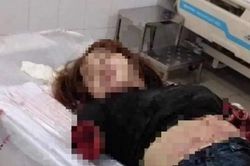Chồng chém đứt hai tay vợ: Nạn nhân có lỗi... nghi phạm nhẹ tội?