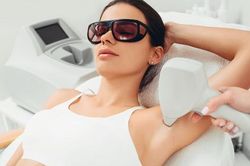 Triệt lông nách bằng laser có an toàn và hiệu quả không?