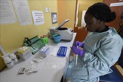 Nigeria: 171 người tử vong vì bệnh xuất huyết cấp tính do virus