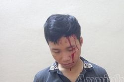 Rủ người yêu mua tiết lợn dựng màn kịch bị bắt cóc để tống tiền mẹ đẻ