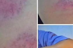 Thầy giáo cấp 2 ở Nghệ An bị tố đánh nữ sinh bầm tím tay