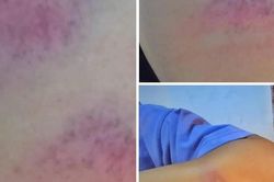 Nghệ An: Thầy giáo bị phụ huynh lên mạng tố đánh nữ sinh lớp 7 bầm tím