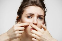 Vì sao người gặp tình trạng da mụn tự ti và ngại dưỡng sáng?