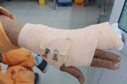 Nhân viên điện lực ở TP.HCM bị hành hung khi đi nhắc nợ