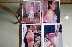 Đề xuất cho thôi việc bảo vệ dân phố bị tố đánh dân