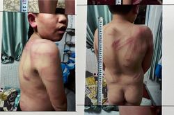 Lâm Đồng: Tạm giữ người cha bạo hành con trai ruột như thời trung cổ