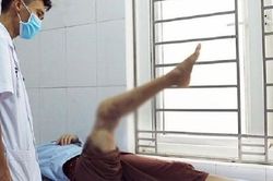 Nếu chẳng may phần chi đứt lìa làm sao để bảo quản đúng trước khi bệnh nhân đến viện?