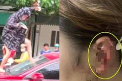 Đập phá xe ô tô, cắn đứt tai người khác vì ghen tuông tại Thanh Hóa: Người vợ đối diện tội danh nào?