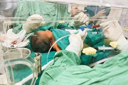 Thay máu toàn phần cứu bé trai 3 ngày tuổi bị vàng da nguy kịch