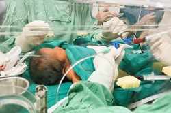 Thay toàn bộ máu cứu sống bệnh nhi 3 ngày tuổi
