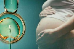 Cô gái 23 tuổi tử vong đột ngột khi lấy trứng thụ tinh ống nghiệm