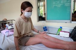 Sốt xuất huyết năm nay bất thường: Đừng tưởng hết sốt là khỏi bệnh
