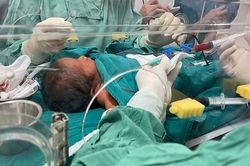 Hải Phòng: Bé sơ sinh 3 ngày tuổi được 'thay máu'