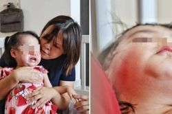 Phụ huynh tố cáo con gái 20 tháng tuổi bị bạo hành