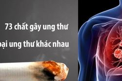 30% số người bị ung thư là do thuốc lá