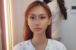Không ưng ý ngoại hình sau nhiều lần phẫu thuật, Lynk Lee quyết tâm 'dao kéo' đến cùng