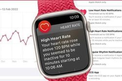 Apple Watch phát hiện được các triệu chứng về tuyến giáp vài tháng trước khi chẩn đoán?