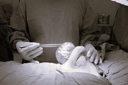 Thiếu nữ 15 tuổi có ngực phải to gấp đôi ngực trái