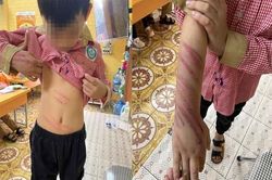 Nhà trường nói về việc bé trai 7 tuổi bị bạn trai của mẹ bạo hành