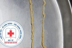 Người phụ nữ nhiễm sán dây do món ăn quen thuộc