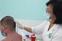 Người đàn ông bị lột da toàn thân vì trị bệnh theo thầy thuốc 'mạng'