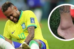 Brazil 'lo sốt vó' với chấn thương của Neymar