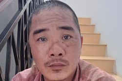 Chém cha nhập viện rồi bỏ trốn