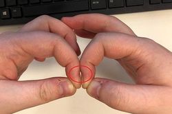 3 dấu hiệu ở ngón tay cảnh báo ung thư phổi