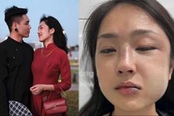 Nghi ngờ bạn trai lăng nhăng, Misoa bị người yêu hành hung