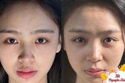 Cô gái có màn thay đổi làn da ngoạn mục nhờ đi ngủ