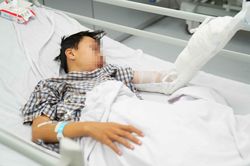 Bình ga mini phát nổ, thiếu niên 13 tuổi bị nát bàn tay trái, bỏng mặt