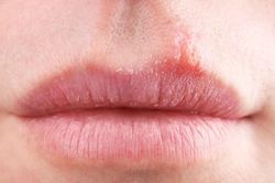 Màu môi tiết lộ bất ngờ về sức khỏe