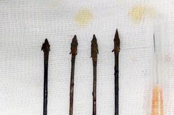 Nghệ An: Nỏ tự chế cướp cò, bé trai 11 tuổi bị mũi tên đâm vào mặt