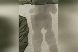 Chàng trai sốt 40 độ gây xôn xao với vết tích để lại khi rời khỏi giường