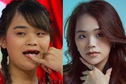Hành trình 'đổi đời' của 'thánh sún' mất 9 cái răng