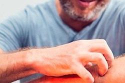 Bị ngứa dữ dội khắp cơ thể, đi khám mới biết mắc ung thư
