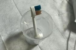 Bác sĩ sửng sốt phát hiện đầu bàn chải điện bên trong bụng cậu bé 9 tuổi