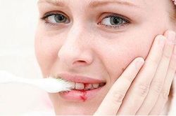 Chảy máu chân răng là dấu hiệu nhiều bệnh nguy hiểm