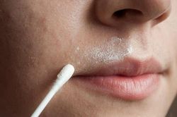 Bất ngờ với 9 công dụng làm đẹp 'rẻ như bèo' từ oxy già ít người biết