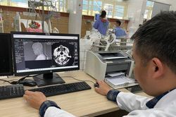 Người suy thận, kẻ bị nhồi máu não sau cuộc rượu