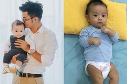 Mẹ sử dụng bỉm quần sớm cho trẻ có thể khiến con bị ảnh hưởng khớp háng?