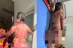 Dùng thuốc không rõ nguồn gốc, người phụ nữ bị nhiễm độc, suýt mất mạng